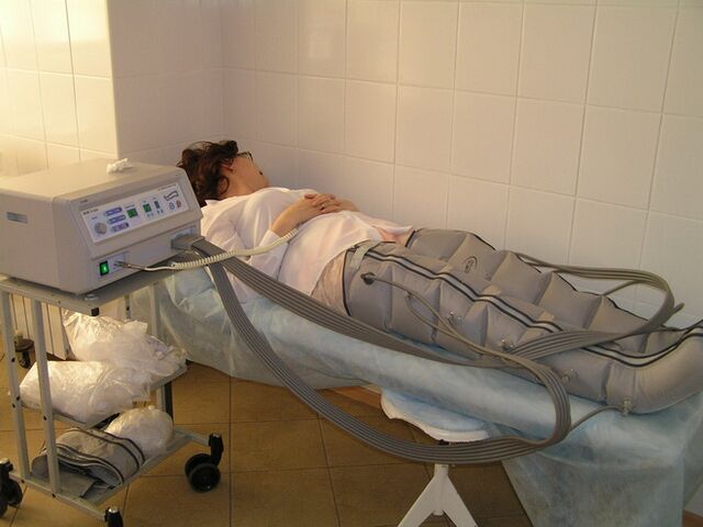 Kompresijska terapija